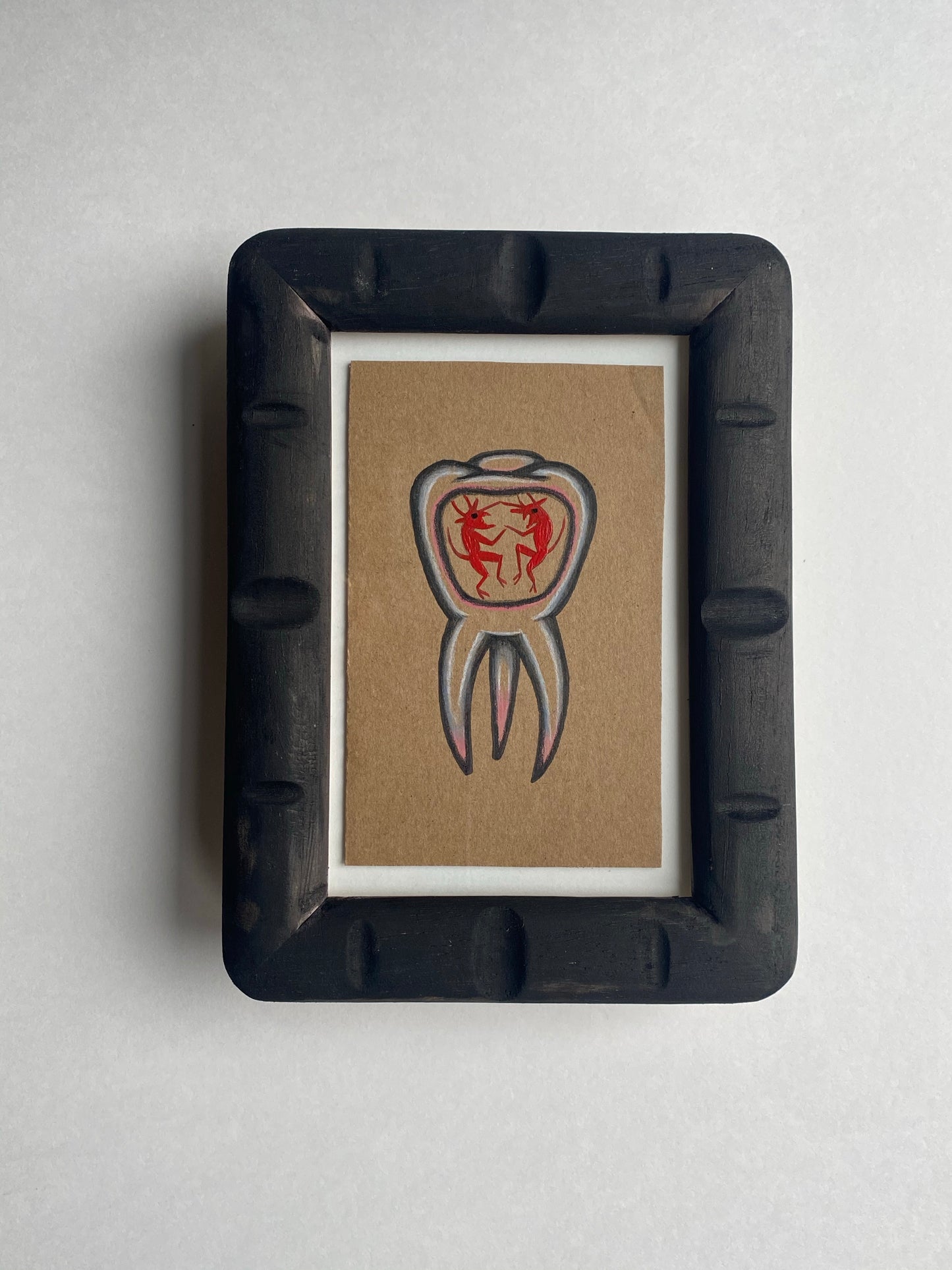 Toothache -  Framed Original